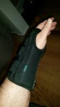 Brokenwrist2.jpg Brokenwrist2.jpg